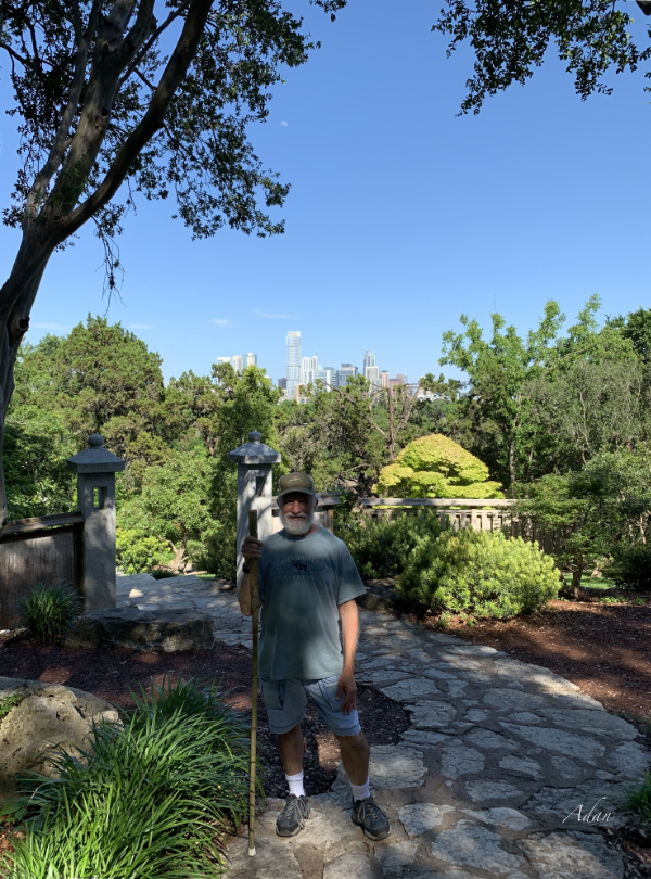 Aging Gracefully – Walking’s Paying Off After Surgery, Step by Step&nbsp;😊