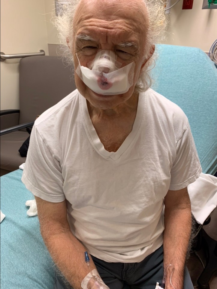 Shortly after surgery Sept 08, 2022 ©Felipe Adan Lerma