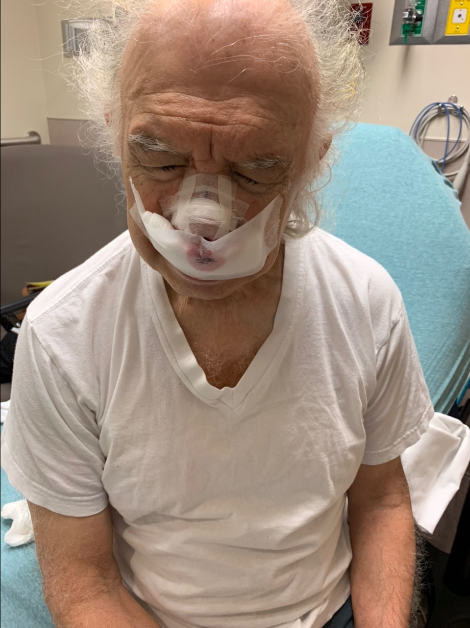 September 09, 2022 – 1st Day After&nbsp;Surgery